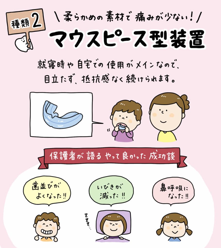 子ども矯正装置_徹底比較_9_子どもの主要な矯正装置（透明アライナー、マウスピース、プレート、ブラケット）を一覧で比較したイラスト