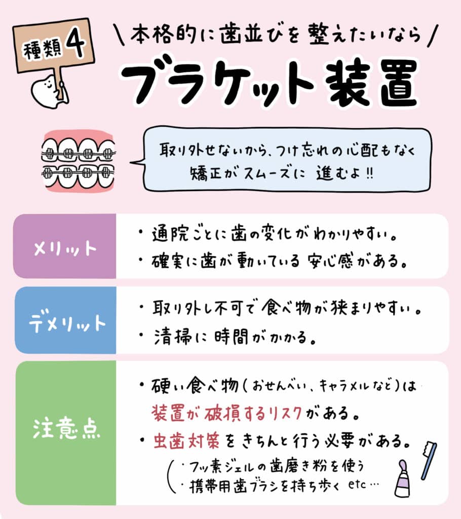 子ども矯正装置_徹底比較_13_子どもの主要な矯正装置（透明アライナー、マウスピース、プレート、ブラケット）を一覧で比較したイラスト